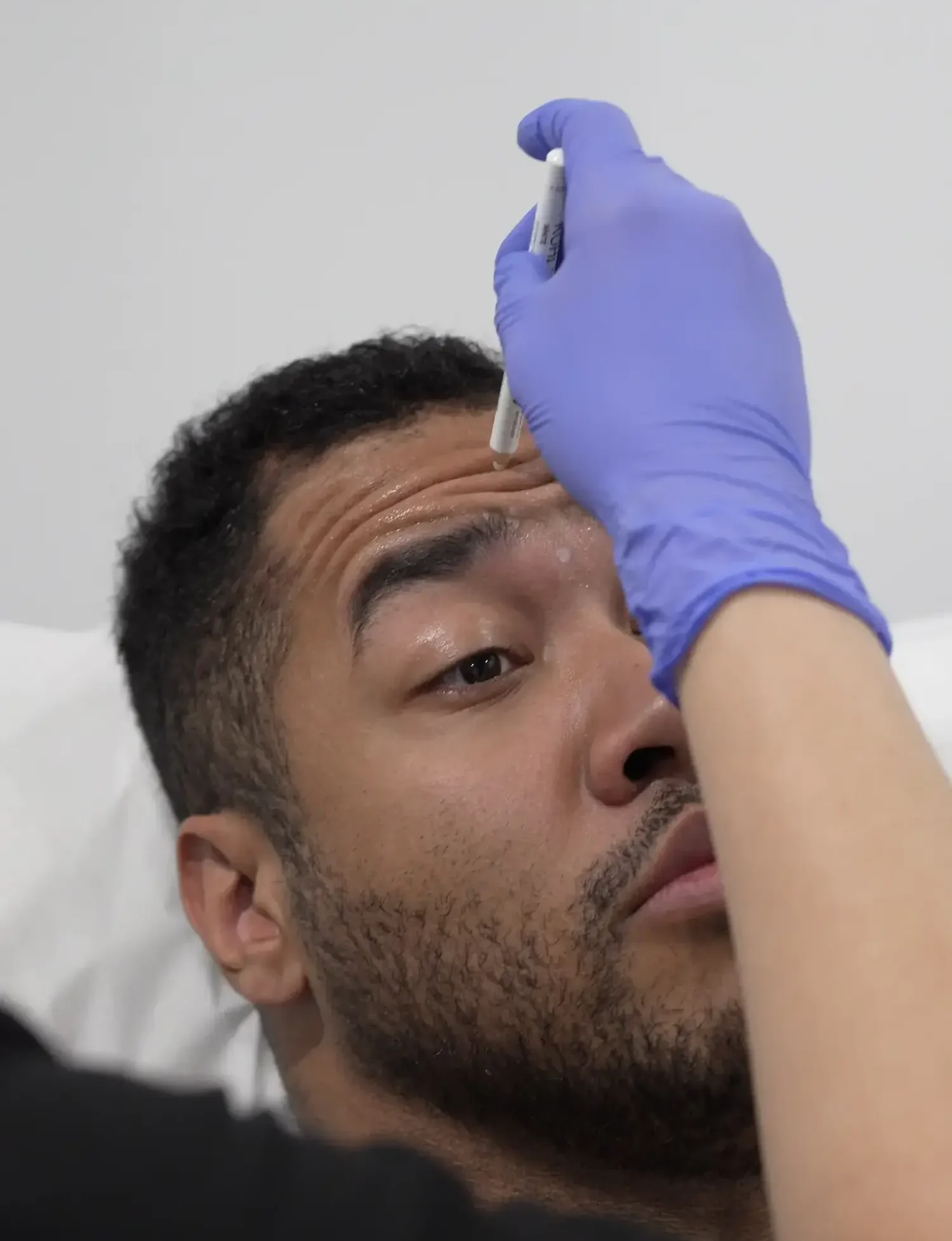 Man preparing for forehead injection